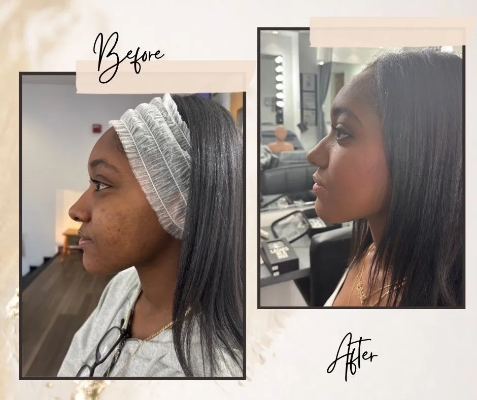 Before-and-after composition showing a side profile of a person wearing a headband in the Before photo and with hair down in the After photo.